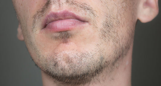 How to Fix a Patchy Beard: 5 Proven Strategies for a Fuller Look
