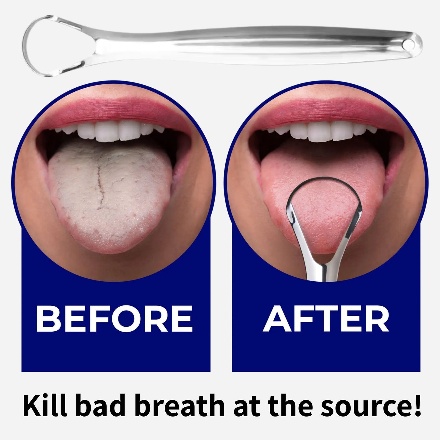 Stainless Steel Tongue Scraper